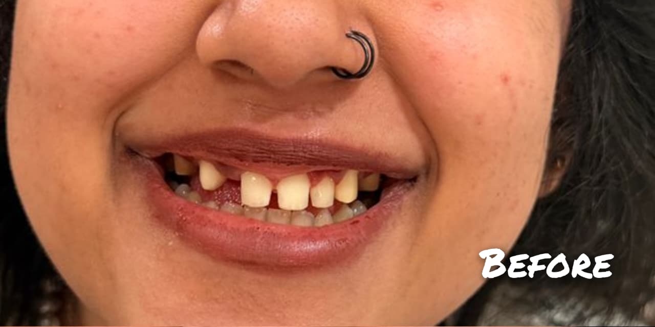 Before treatment