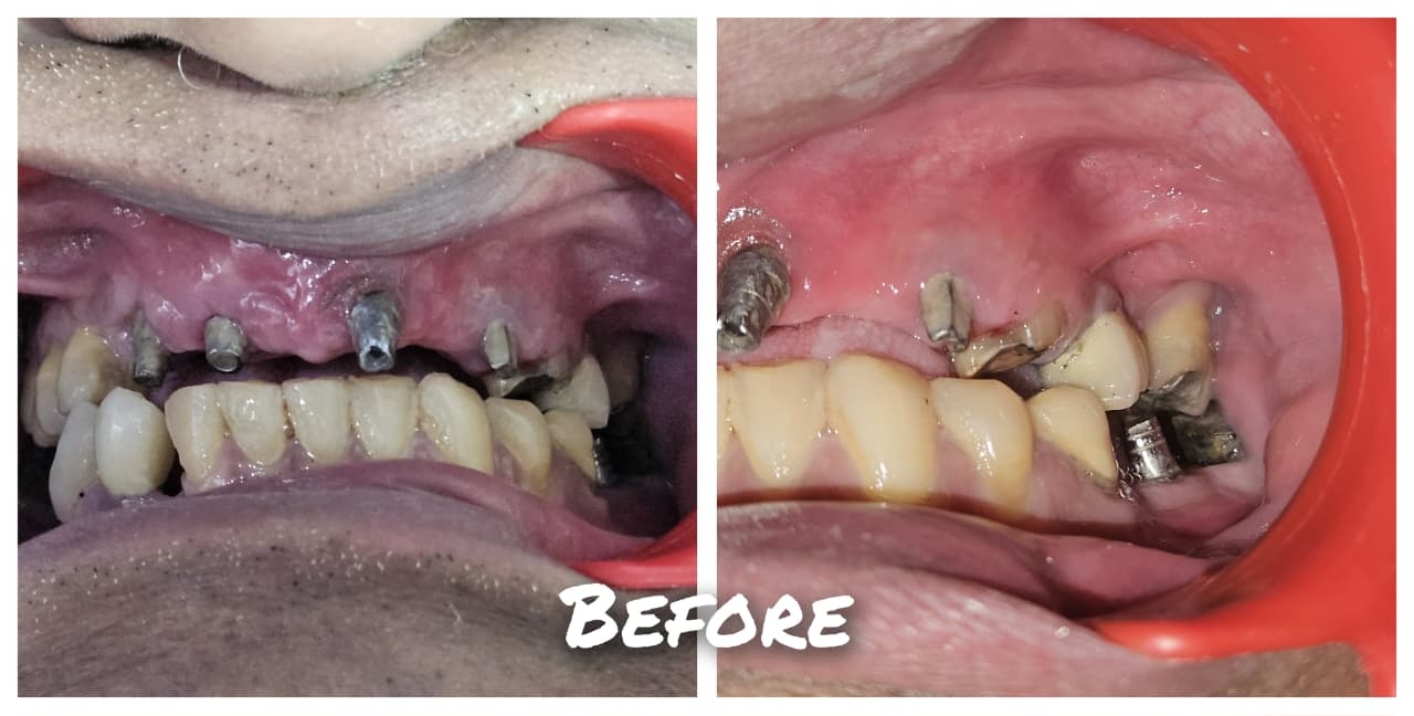 Before treatment