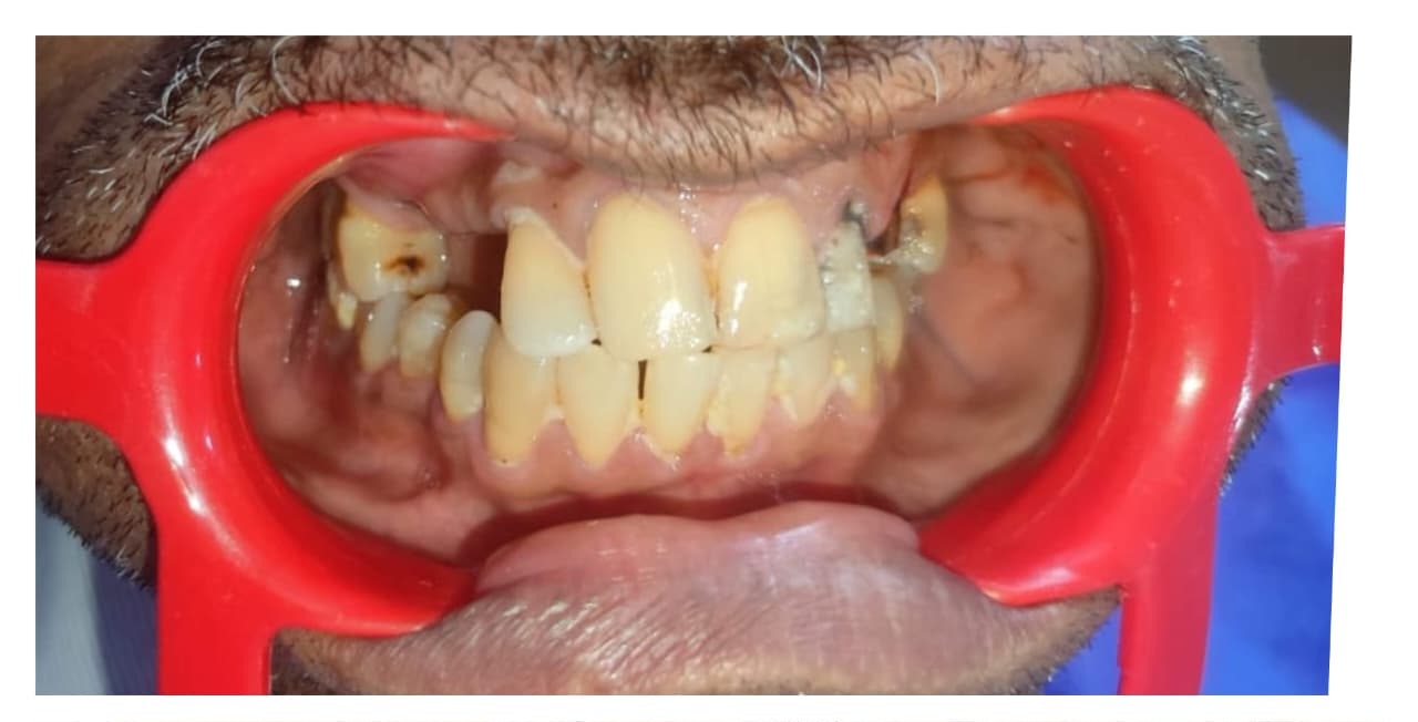 Before treatment